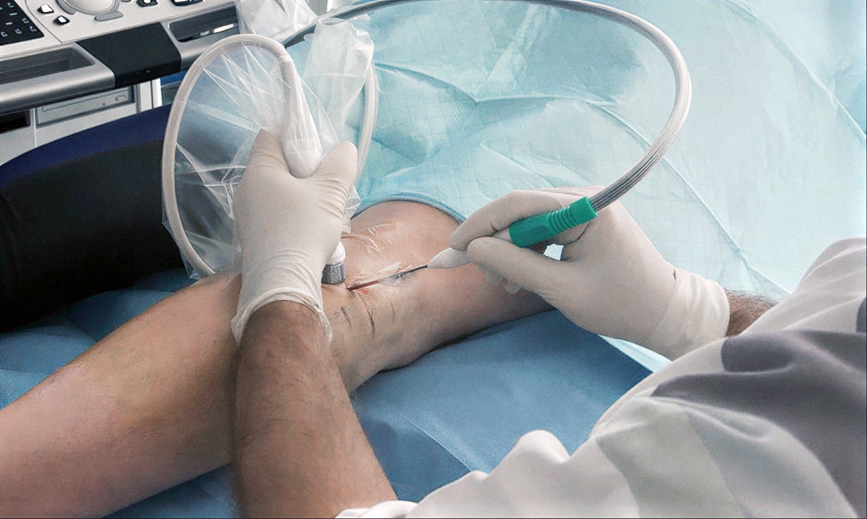 Cryoneurolysis in Spasticity | 24 - 25.10.2026 | Warsaw